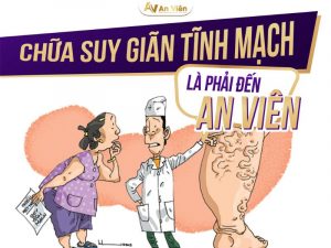 Suy giãn tĩnh mạch khám ở đâu