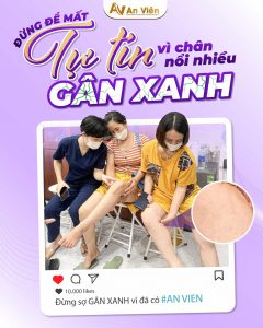 Điều trị suy giãn tĩnh mạch ở đâu Hà Nội