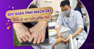 Tại sao tay bị nổi gân xanh