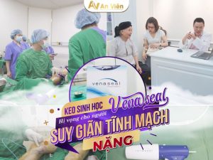 Điều trị bệnh tĩnh mạch tại Hà Nội