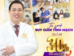 Địa điểm khám bệnh suy giãn tĩnh mạch