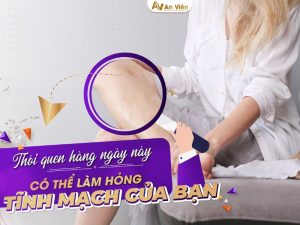 Giãn tĩnh mạch có nguy hiểm không