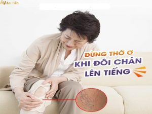 Chân nổi gân xanh