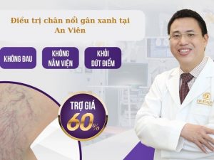 Chân nổi nhiều gân xanh