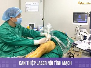 đốt laser tĩnh mạch