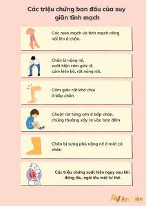 Dấu hiệu giãn tĩnh mạch
