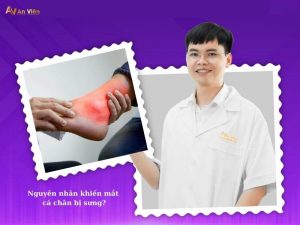mắt cá chân bị sưng
