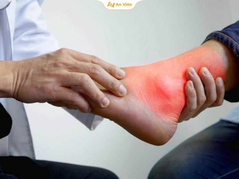 Mắt cá chân bị sưng: Nguyên nhân và cách xử lý an toàn 18 Khi sưng không cải thiện sau chăm sóc tại nhà