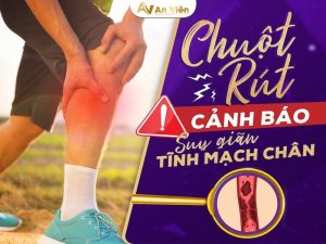 nguyên nhân bị chuột rút bắp chân khi ngủ