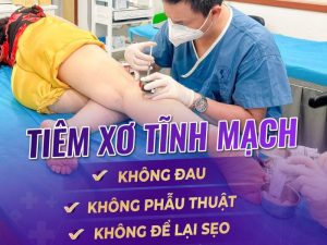 Địa điểm điều trị tĩnh mạch Hà Nội