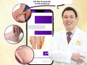 sưng mắt cá chân là bệnh gì