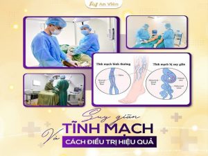 Hà Nội khám tĩnh mạch ở đâu?