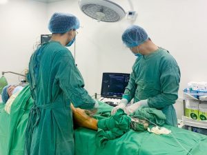 bảng giá laser nội mạch