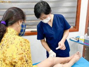 Cách chữa giãn tĩnh mạch tại nhà