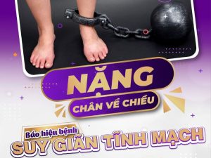 Cách nhận biết suy giãn tĩnh mạch