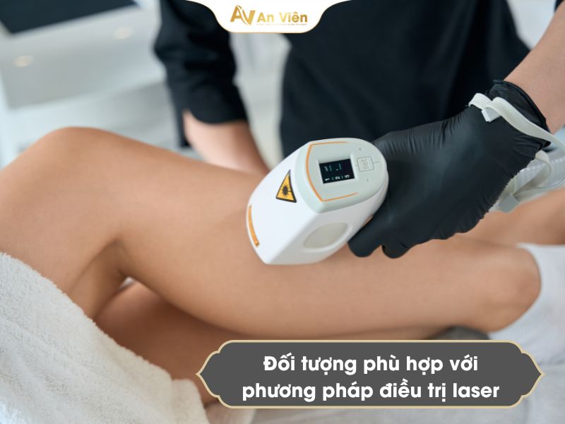 chi phí bắn laser giãn tĩnh mạch