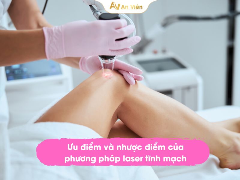 chi phí bắn laser giãn tĩnh mạch