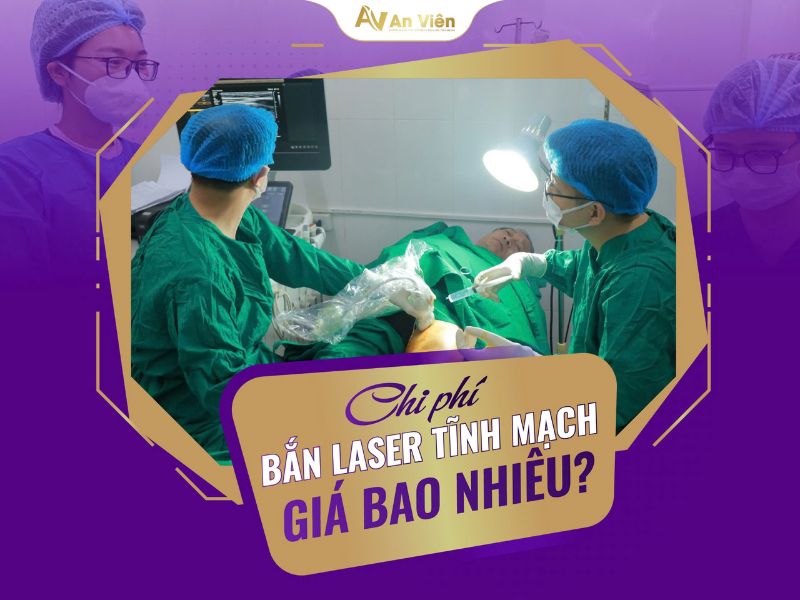 chi phí bắn laser giãn tĩnh mạch