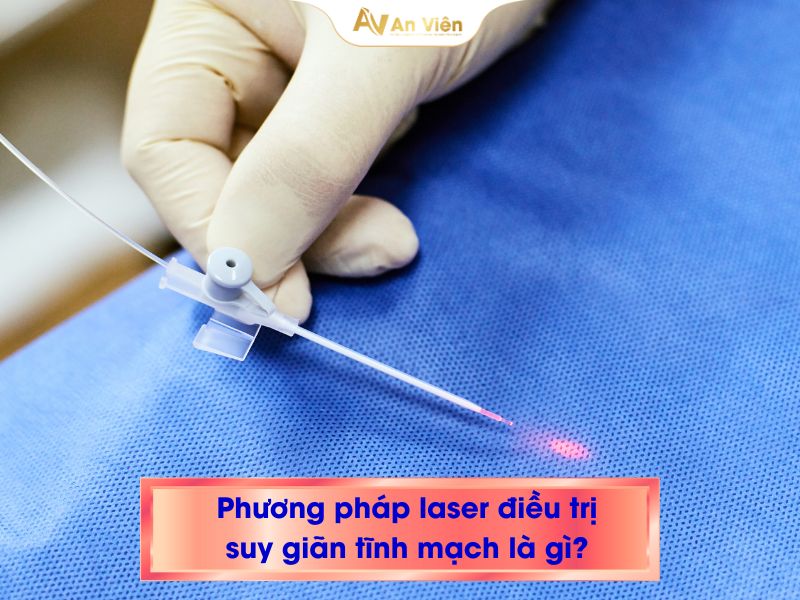 chi phí bắn laser giãn tĩnh mạch