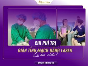 chi phí điều trị giãn tĩnh mạch chân bằng laser