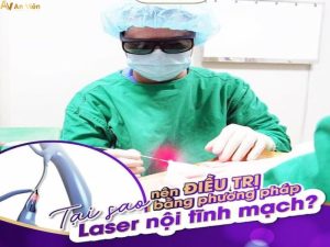 điều trị giãn tĩnh mạch bằng laser