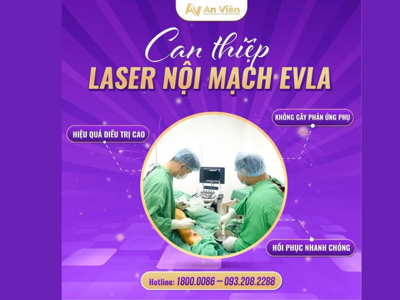 điều trị suy giãn tĩnh mạch bằng laser 