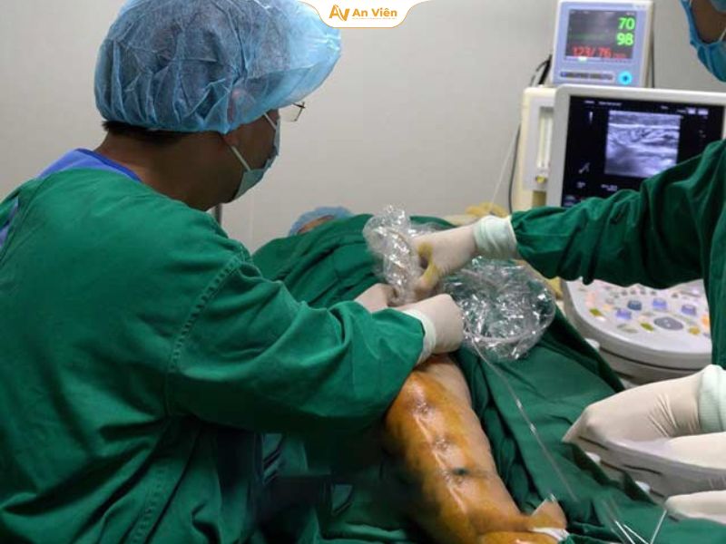 Đốt laser giãn tĩnh mạch chân: Ưu điểm, đối tượng phù hợp và chi phí 8 Đốt laser suy tĩnh mạch chân tại Tĩnh mạch An Viên