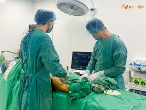 Đốt laser giãn tĩnh mạch chân An Viên