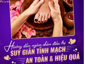 giãn tĩnh mạch có ngâm chân được không
