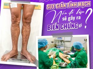Khoa khám tĩnh mạch An Viên
