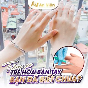 tiêm xơ tĩnh mạch tay một