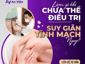 cách xoa bóp suy giãn tĩnh mạch