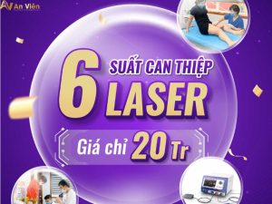 chi phí điều trị giãn tĩnh mạch laser