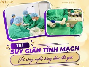điều trị suy giãn tĩnh mạch bằng laser