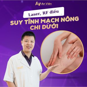 giá điều trị giãn tĩnh mạch bằng laser
