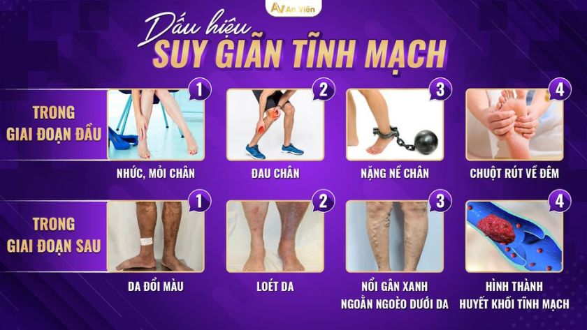 giãn cơ chân có tác dụng gì