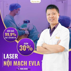 can thiệp laser nội mạch EVLA