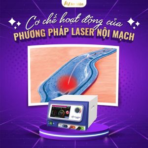 laser tĩnh mạch khám ở đâu một