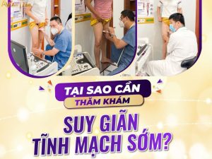 phác đồ điều trị suy giãn tĩnh mạch