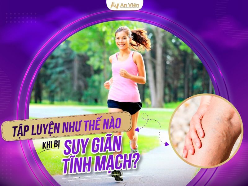 suy giãn tĩnh mạch có nên đi bộ không 
