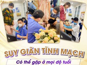 suy giãn tĩnh mạch là bệnh gì