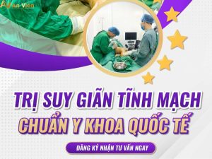 suy giãn tĩnh mạch và cách điều trị