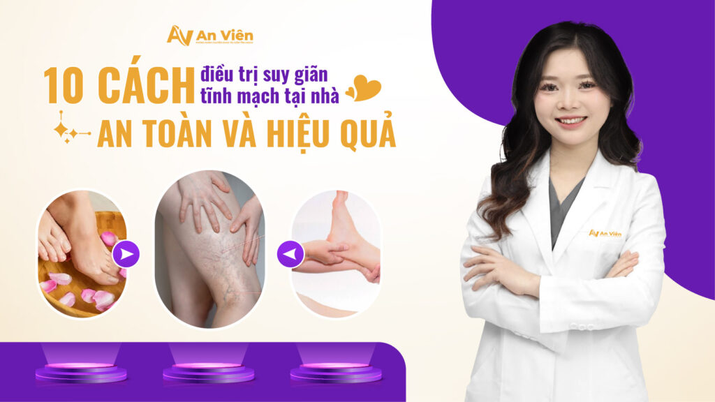 10+ Cách điều trị suy giãn tĩnh mạch tại nhà an toàn và hiệu quả