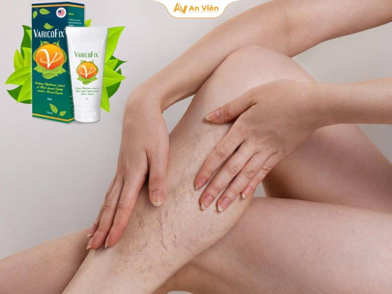 Kem suy giãn tĩnh mạch Varicofix