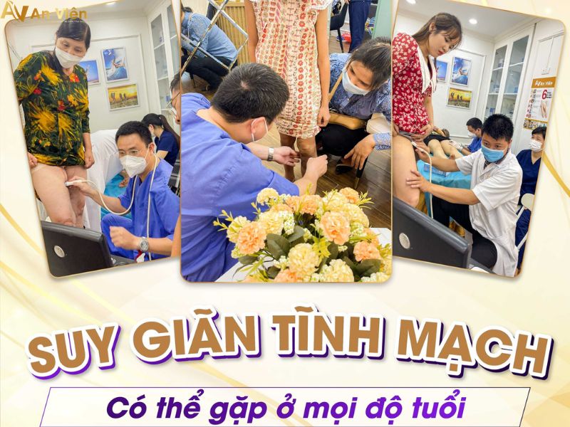 4 dấu hiệu suy giãn tĩnh mạch