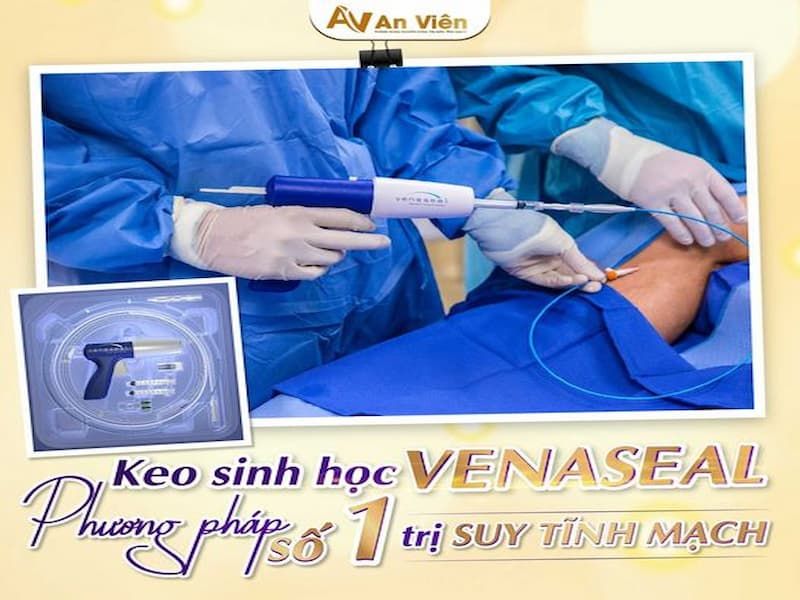 hiện tượng suy giãn tĩnh mạch