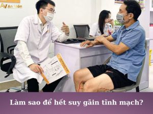 làm sao để chữa suy giãn tĩnh mạch chân