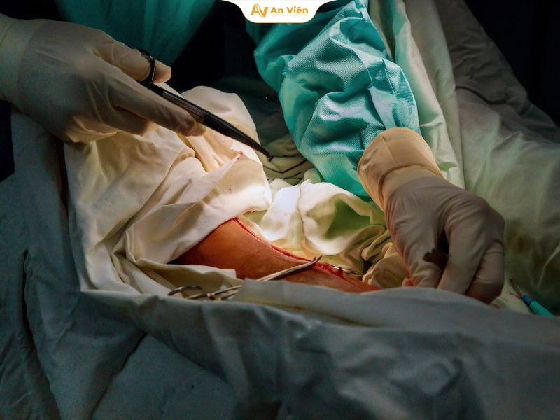 Suy giãn tĩnh mạch có phải mổ không