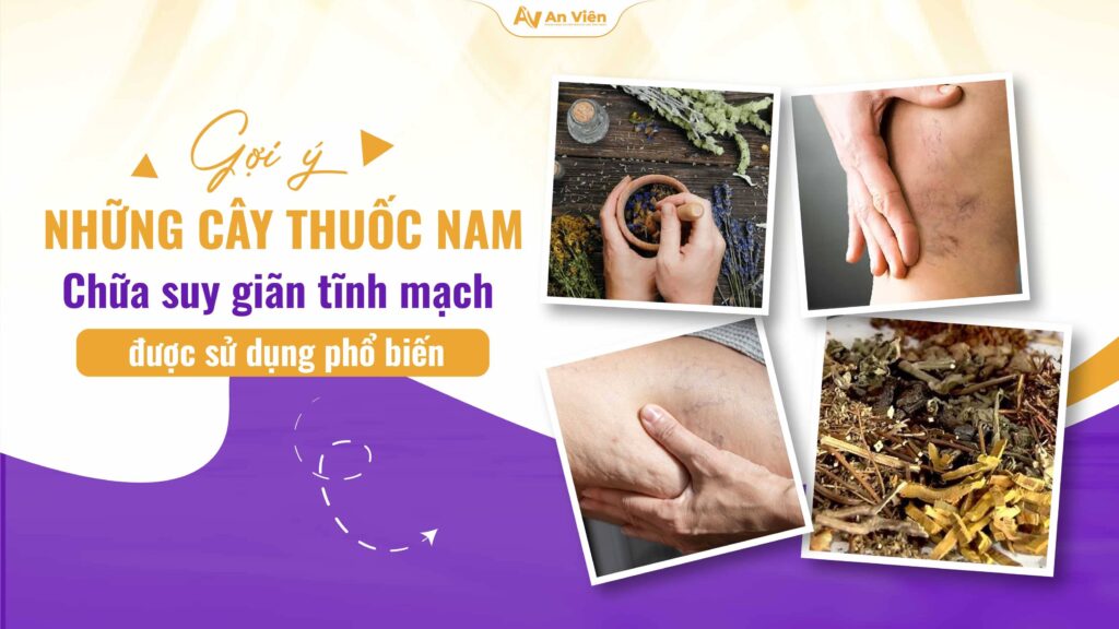 Gợi ý những cây thuốc nam chữa suy giãn tĩnh mạch được sử dụng phổ biến