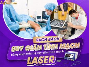 máy laser điều trị suy giãn tĩnh mạch